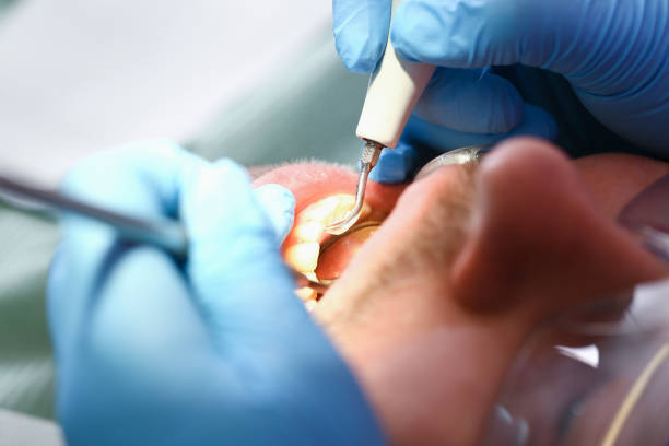 Best Emergency Treatment for Toothache in Silver Lake, KS