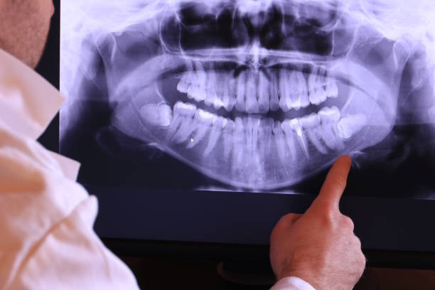 Best Emergency Dental Surgery in Silver Lake, KS