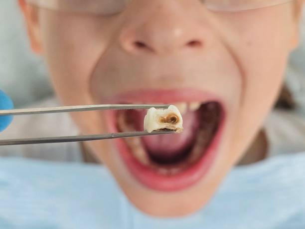 Best Emergency Dental Care for Trauma or Injury in Silver Lake, KS